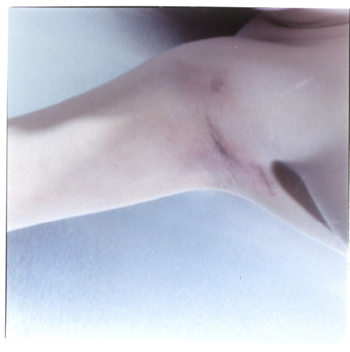 Lapse Into Reflex 3 ©2002